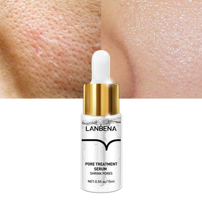 LANBENA PORE TREATMENT SERUM[NPRA]