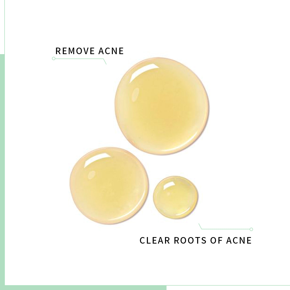 LANBENA Acne Clear Serum (15ml) [FDA]